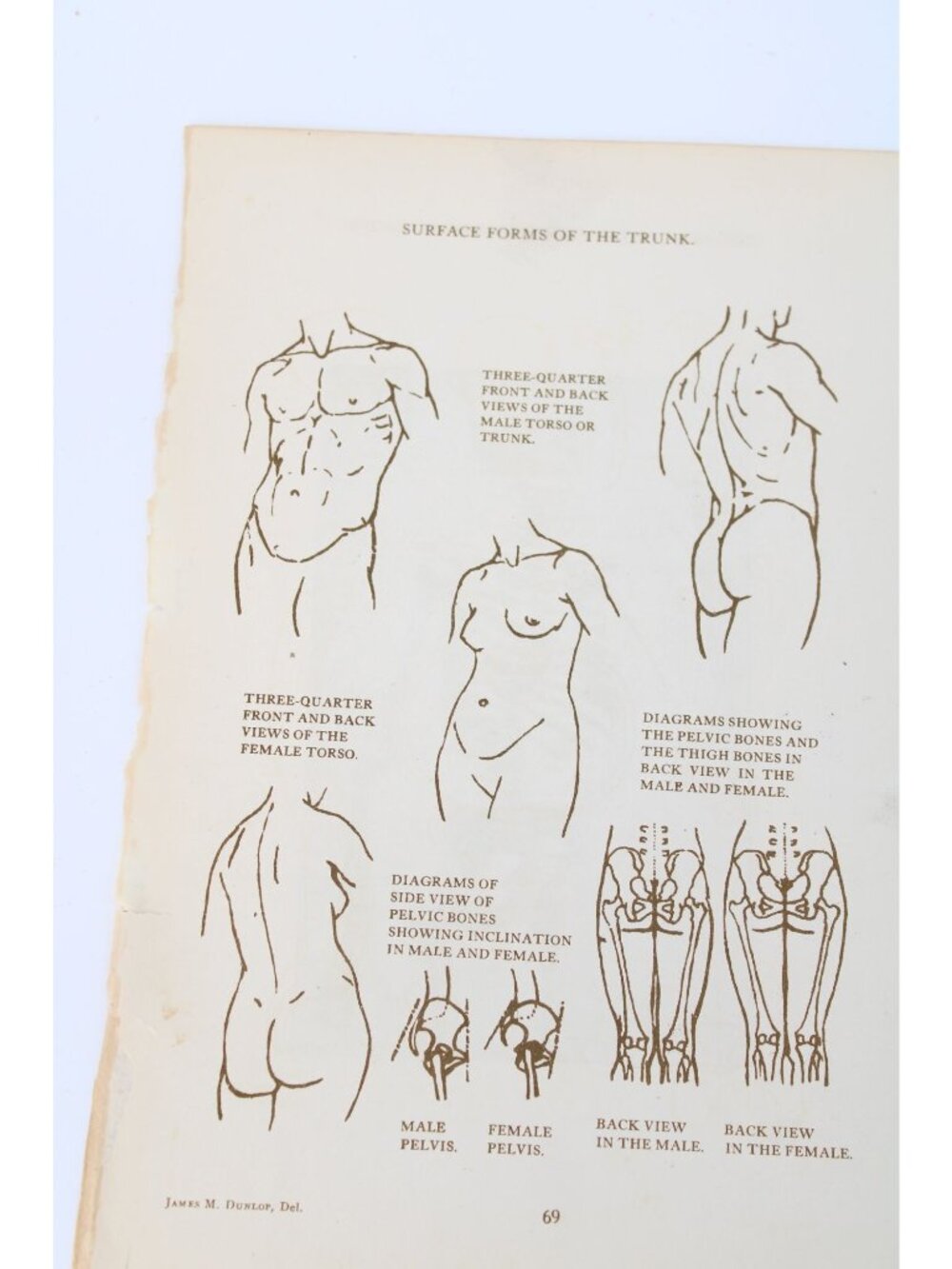1946 Anatomical Diagram Art Students Surface Forms of Trunk Vintage 94638